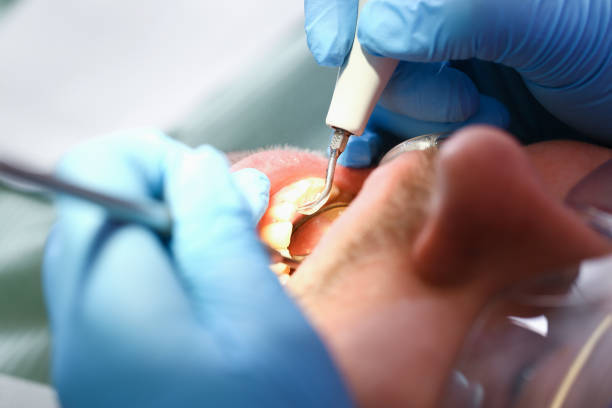 Best Emergency Broken Tooth Repair in Gulfport, MS